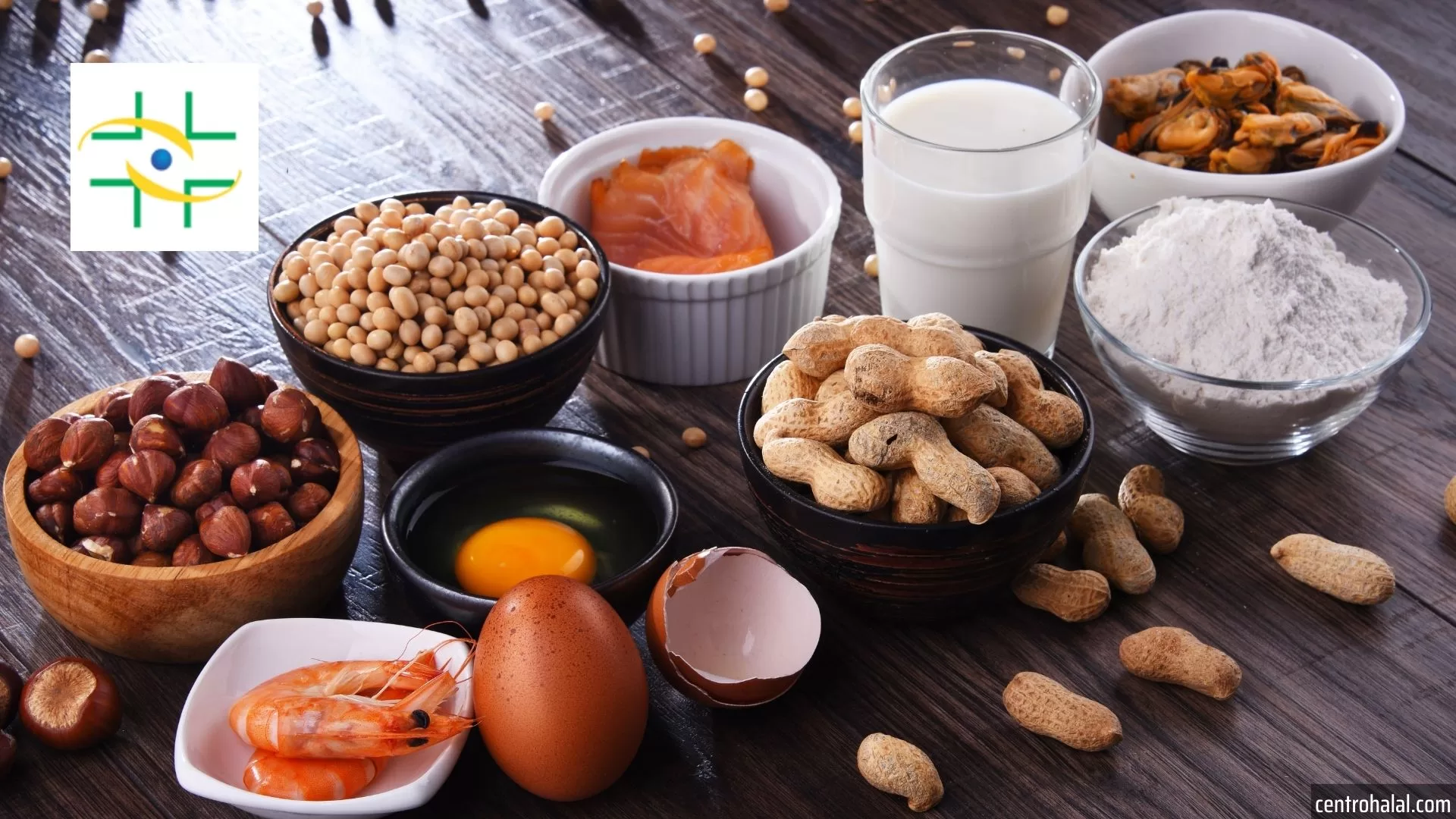 Revisão da Regulamentação da ANVISA sobre Rotulagem de Alimentos Alergênicos: Análise das Propostas para 2025